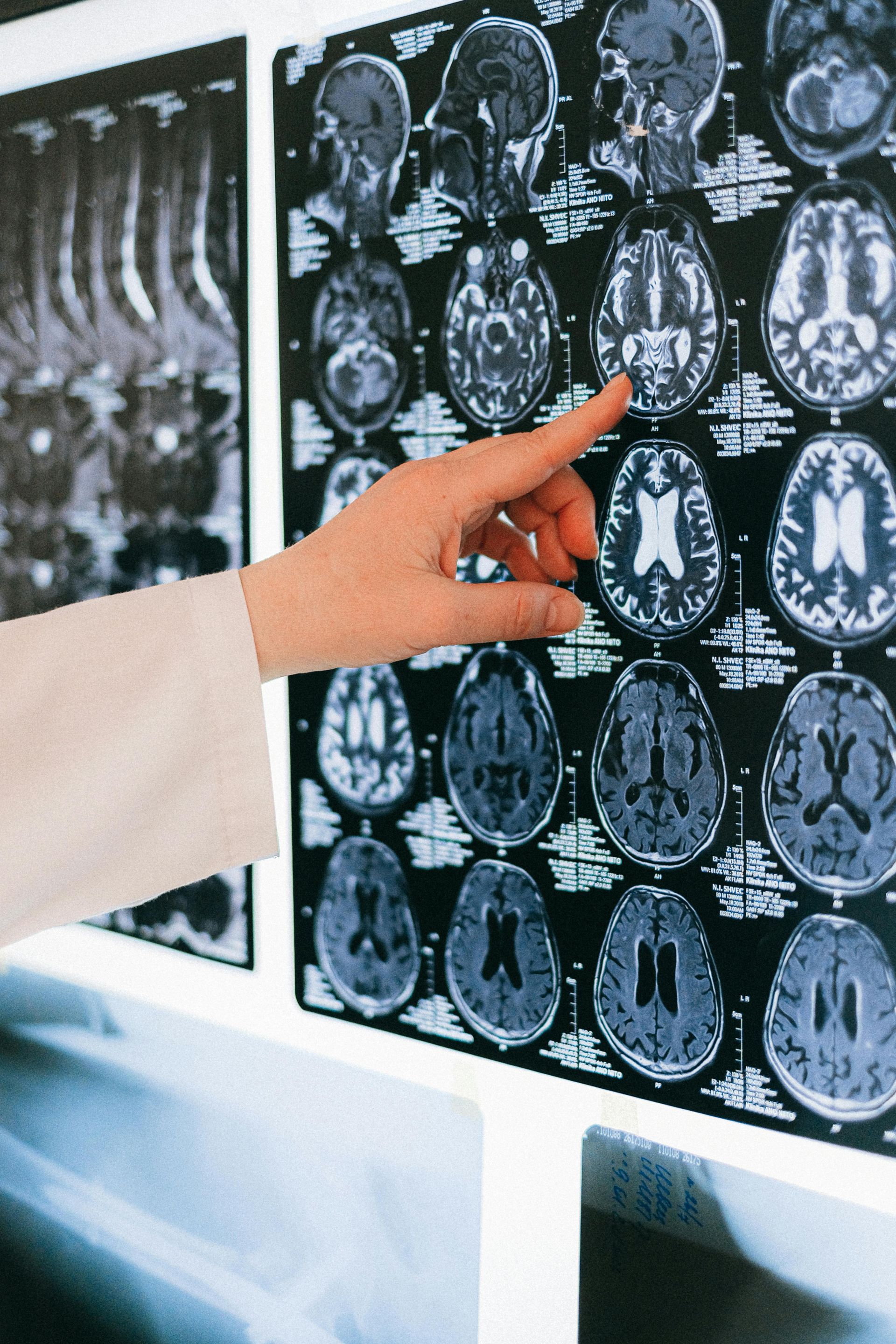 What is CT Scan Imaging?